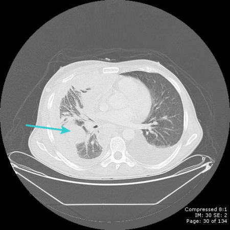 com.bmj.content.model.assessment.Caption@12c60dc0