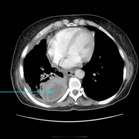 com.bmj.content.model.assessment.Caption@25db0a55