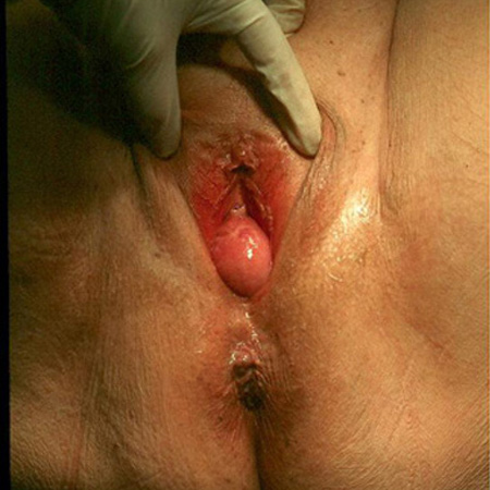 com.bmj.content.model.Caption@65e65edb