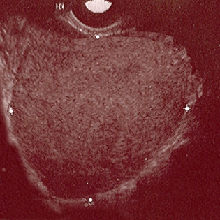 com.bmj.content.model.assessment.Caption@405866c5