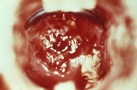 com.bmj.content.model.assessment.Caption@1394bd5