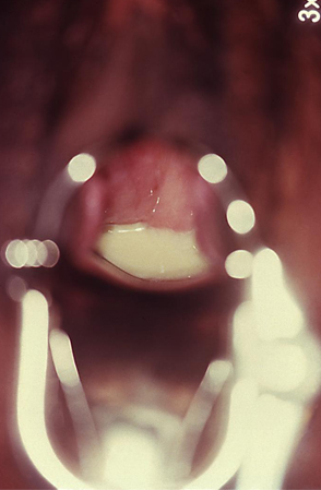 com.bmj.content.model.assessment.Caption@5c7f90b1
