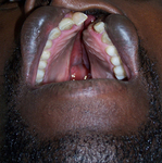 27