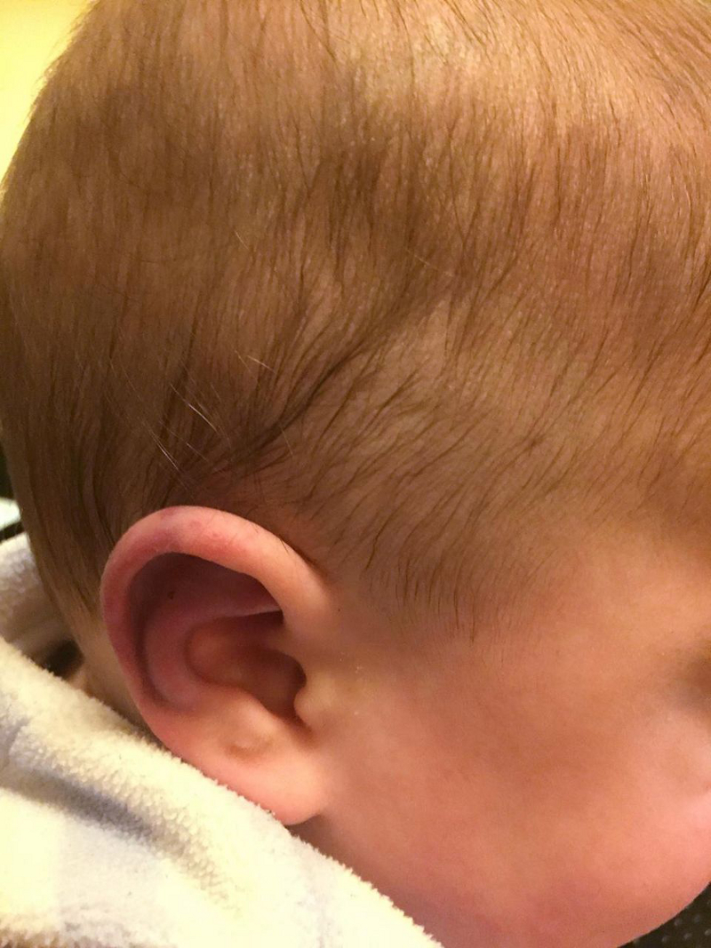 Abusive head trauma in infants and young children images