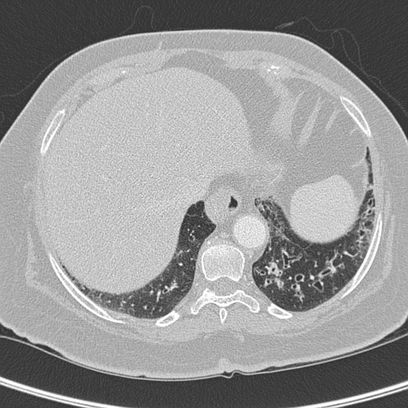 com.bmj.content.model.assessment.Caption@769db40d