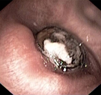 com.bmj.content.model.assessment.Caption@4849ab64