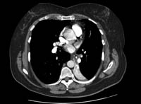 com.bmj.content.model.assessment.Caption@532ac250