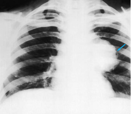 com.bmj.content.model.assessment.Caption@3deb2c01