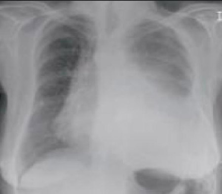 com.bmj.content.model.assessment.Caption@292605bb