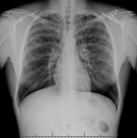 com.bmj.content.model.assessment.Caption@2b7f8b8