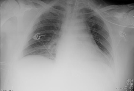 com.bmj.content.model.assessment.Caption@4194a30c