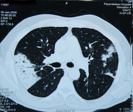 com.bmj.content.model.assessment.Caption@7360c636
