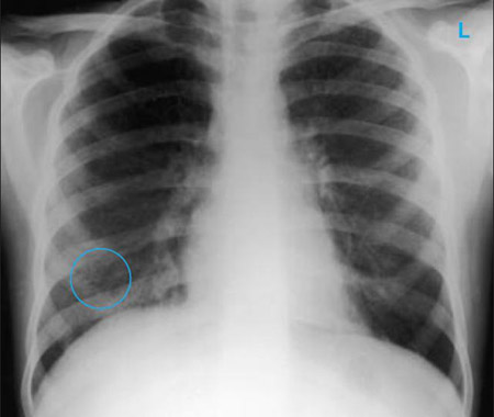 com.bmj.content.model.assessment.Caption@2274adea
