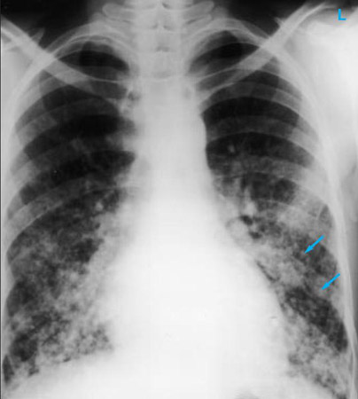 com.bmj.content.model.assessment.Caption@1ec6f8eb