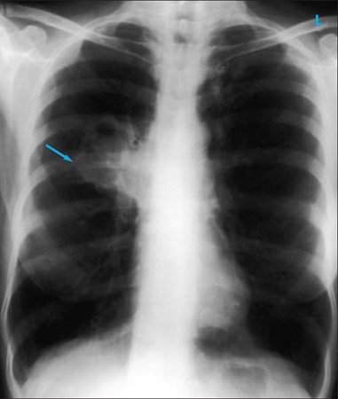 com.bmj.content.model.assessment.Caption@233f41d3