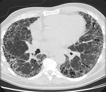 com.bmj.content.model.assessment.Caption@c191e44