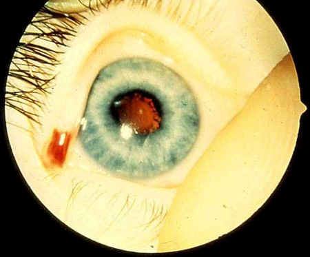 com.bmj.content.model.assessment.Caption@3067cea5