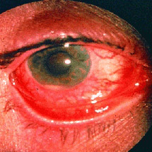 com.bmj.content.model.assessment.Caption@339de28f