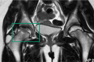 com.bmj.content.model.assessment.Caption@4691fa19