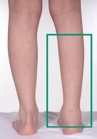 com.bmj.content.model.assessment.Caption@37c8a1c5