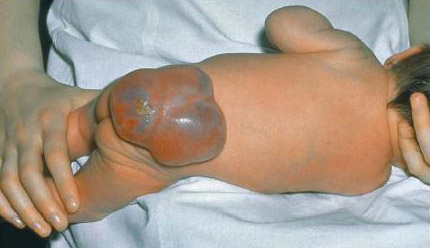 com.bmj.content.model.assessment.Caption@5a2c28ec