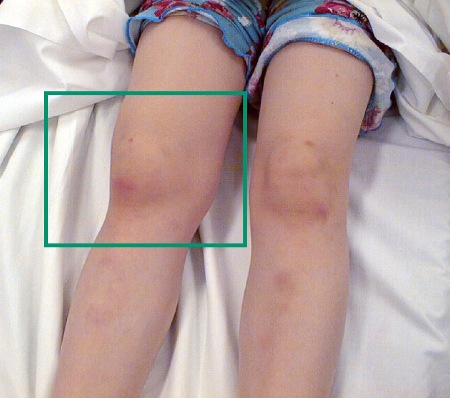 com.bmj.content.model.assessment.Caption@2965a616