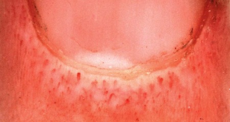 com.bmj.content.model.assessment.Caption@5191814c