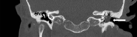 com.bmj.content.model.assessment.Caption@64954d98