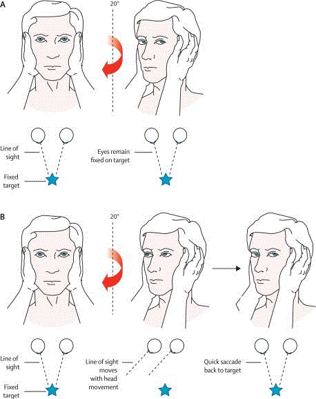 com.bmj.content.model.assessment.Caption@4715732c