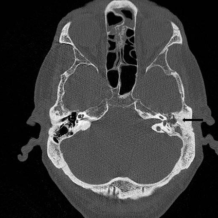 com.bmj.content.model.assessment.Caption@79620e8e