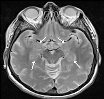 com.bmj.content.model.assessment.Caption@86256b8
