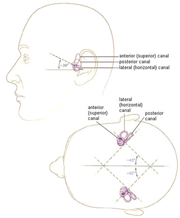 Benign paroxysmal positional vertigo images
