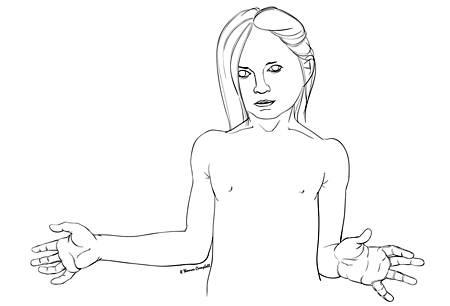 Brachial plexus birth injury images
