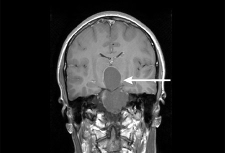 Assessment of short stature images