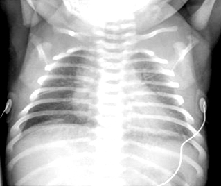 com.bmj.content.model.assessment.Caption@48800da