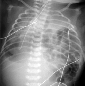 com.bmj.content.model.assessment.Caption@507df8a1