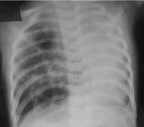 com.bmj.content.model.assessment.Caption@59ba5c28