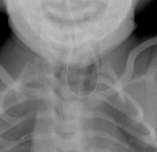 com.bmj.content.model.assessment.Caption@30e7027d