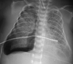 com.bmj.content.model.assessment.Caption@e3ff055