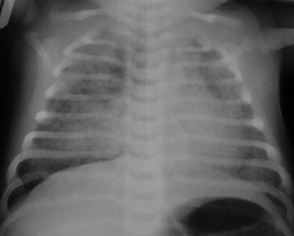 com.bmj.content.model.assessment.Caption@12a1b6e