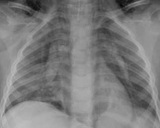 com.bmj.content.model.assessment.Caption@5715808a