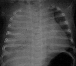 com.bmj.content.model.assessment.Caption@161731f5