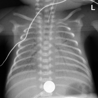 com.bmj.content.model.assessment.Caption@21e5f015