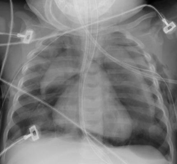 com.bmj.content.model.assessment.Caption@6c25b06a