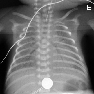 Avaliação da cianose neonatal images