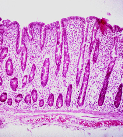 Assessment of steatorrhoea images
