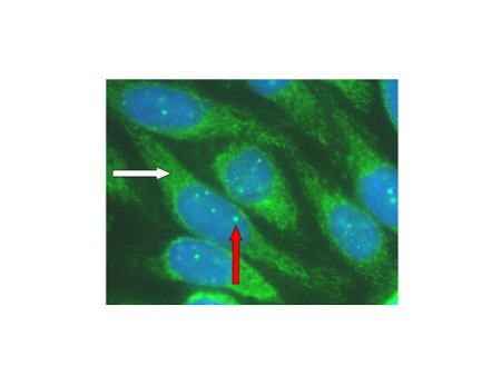 com.bmj.content.model.assessment.Caption@75f1ac75