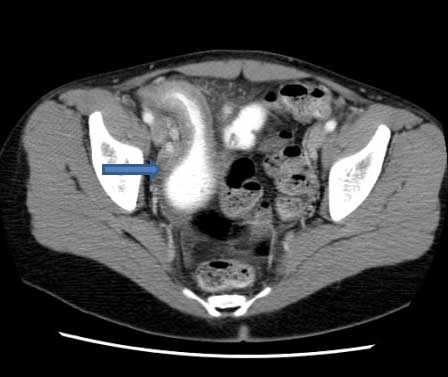 com.bmj.content.model.assessment.Caption@5cc65d81