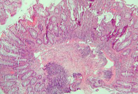 com.bmj.content.model.assessment.Caption@55819ba2