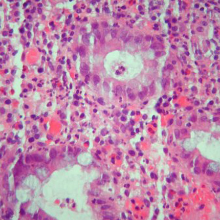 com.bmj.content.model.assessment.Caption@2070c48e